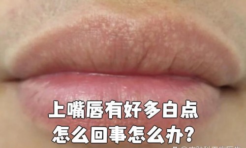 瘦脂肪型大腿的方法-专业瘦脂肪型大腿的方法有哪些平台-瘦脂肪型大腿的方法图片